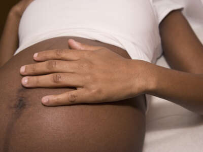 A pregnant woman lying on an exam table, midsection