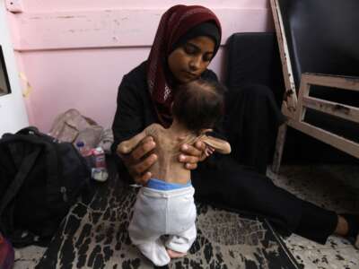Yasmine, a 22-year-old Palestinian mother, holds her malnourished 2-month-old daughter Teen as they await treatment at the Nasser Hospital in Khan Younis in the southern Gaza Strip on July 24, 2025. More than 100 aid organizations and human rights groups warned that mass starvation was spreading in Gaza.